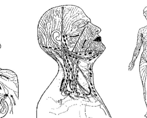 strojna limfna drenaža 1 (1)